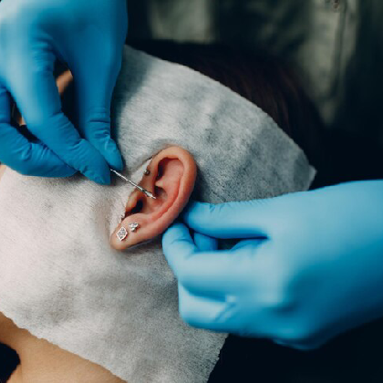 Ear surgery Risks