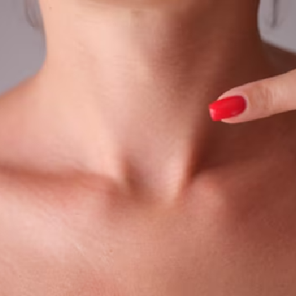 Thyroid causes
