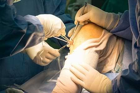 Arthroscopy Surgery by axis hospital in mumbai