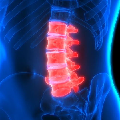 Spinal Cord Injury Treatment in Mumbai 